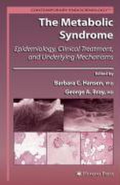 The Metabolic Syndrome: