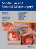 Middle Ear and Mastoid Microsurgery