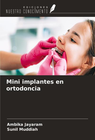 Mini implantes en ortodoncia