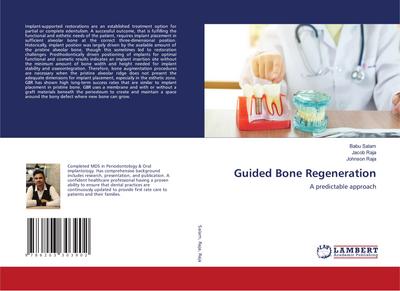 Guided Bone Regeneration
