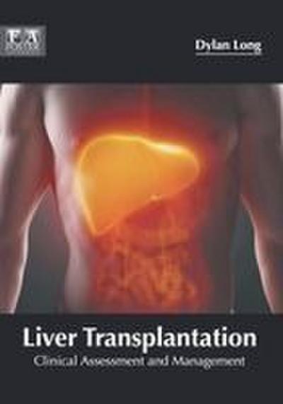 Liver Transplantation