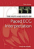 The Nuts and bolts of Paced ECG Interpretation