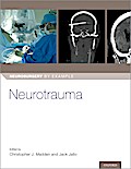 Neurotrauma