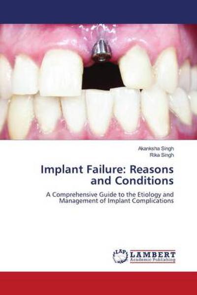Implant Failure: Reasons and Conditions