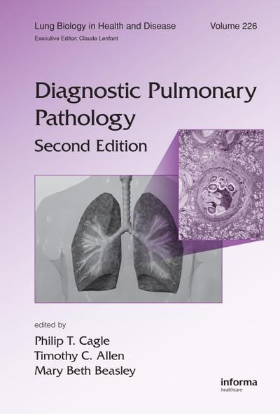 Diagnostic Pulmonary Pathology