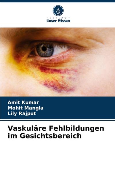 Vaskuläre Fehlbildungen im Gesichtsbereich