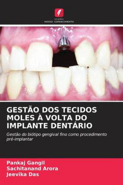 GESTÃO DOS TECIDOS MOLES À VOLTA DO IMPLANTE DENTÁRIO