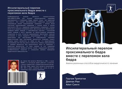 Ipsilateral’nyj perelom proximal’nogo bedra wmeste s perelomom wala bedra