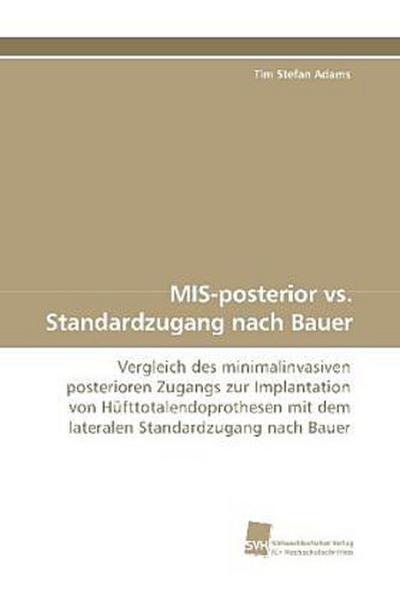 MIS-posterior vs. Standardzugang nach Bauer
