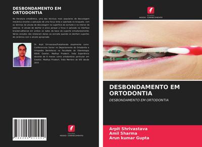 DESBONDAMENTO EM ORTODONTIA