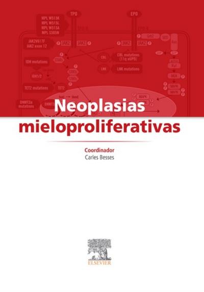 Neoplasias mieloproliferativas