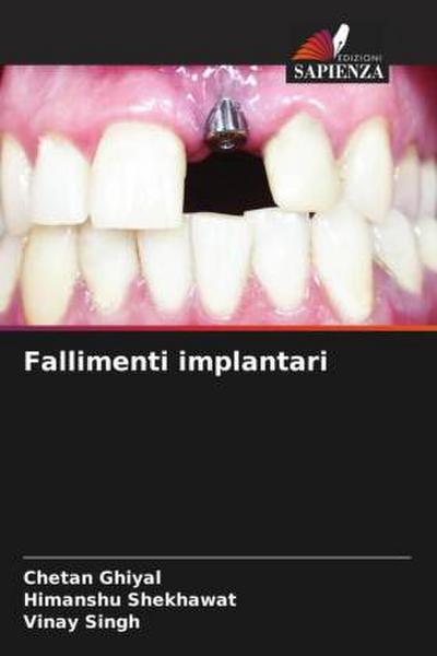 Fallimenti implantari