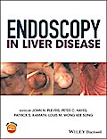 Endoscopy in Liver Disease