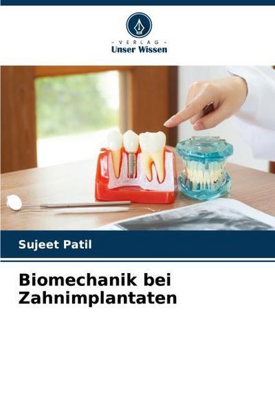 Biomechanik bei Zahnimplantaten