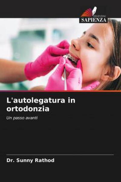 L’autolegatura in ortodonzia