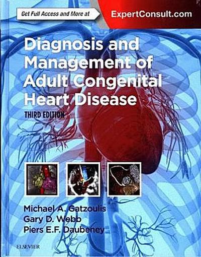 Diagnosis and Management of Adult Congenital Heart Disease