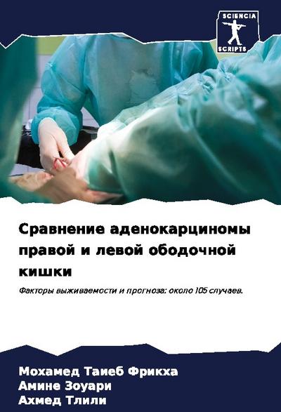 Srawnenie adenokarcinomy prawoj i lewoj obodochnoj kishki