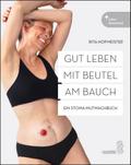 Gut leben mit Beutel am Bauch