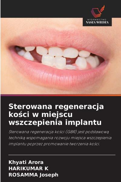 Sterowana regeneracja ko¿ci w miejscu wszczepienia implantu