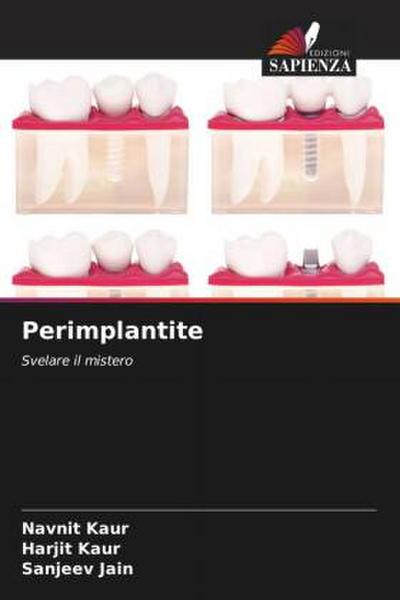 Perimplantite