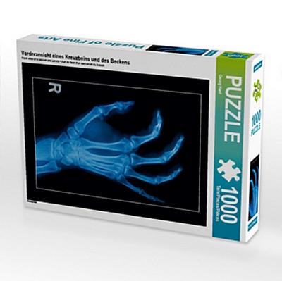 Vorderansicht eines Kreuzbeins und des Beckens (Puzzle)