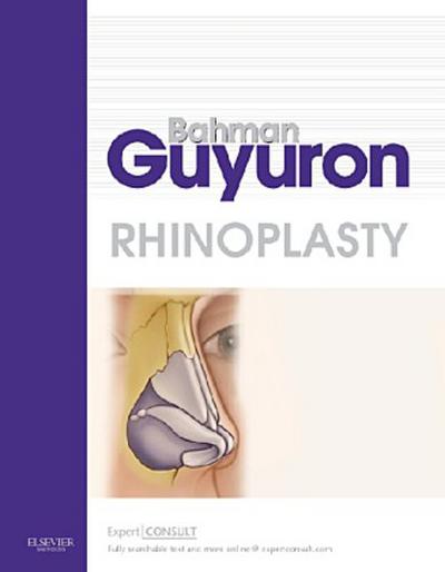 Rhinoplasty