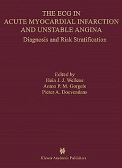 ECG in Acute Myocardial Infarction and Unstable Angina