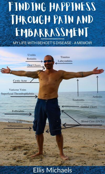 Finding Happiness Through Pain And Embarrassment: My Life With Behcet’s Disease - A Memoir