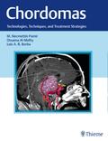 Chordomas