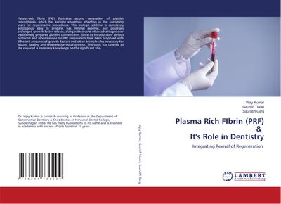 Plasma Rich FIbrin (PRF) & It’s Role in Dentistry