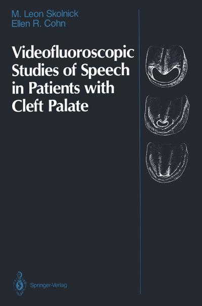 Videofluoroscopic Studies of Speech in Patients with Cleft Palate