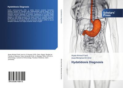 Hydatidosis Diagnosis