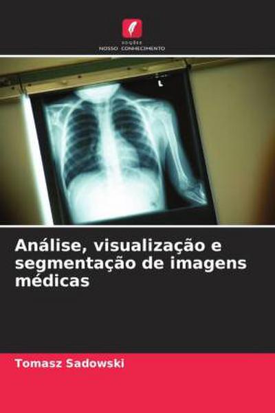 Análise, visualização e segmentação de imagens médicas