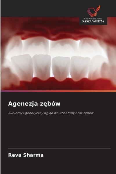 Agenezja z&#281;bów
