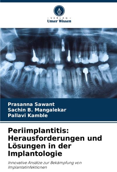 Periimplantitis: Herausforderungen und Lösungen in der Implantologie