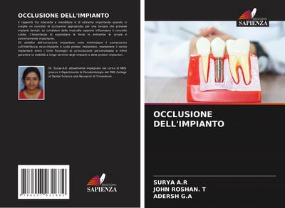 OCCLUSIONE DELL’IMPIANTO