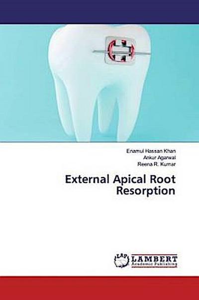 External Apical Root Resorption