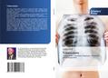 Tuberculosis