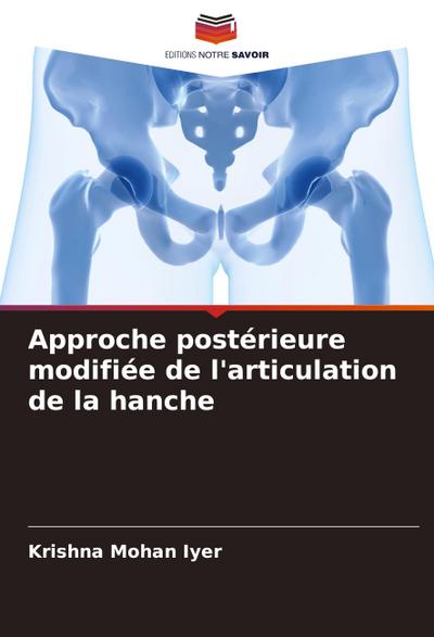 Approche postérieure modifiée de l’articulation de la hanche