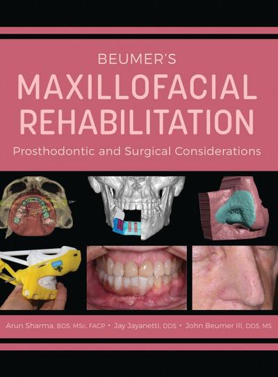 Beumer’s Maxillofacial Rehabilitation
