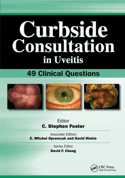 Curbside Consultation in Uveitis