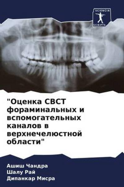 "Ocenka CBCT foraminal’nyh i wspomogatel’nyh kanalow w werhnechelüstnoj oblasti"