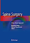 Spine Surgery