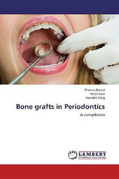 Bone grafts in Periodontics
