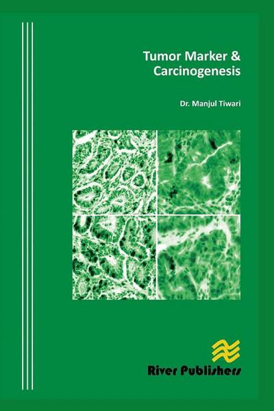 Tumor Marker and Carcinogenesis