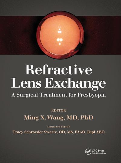 Refractive Lens Exchange
