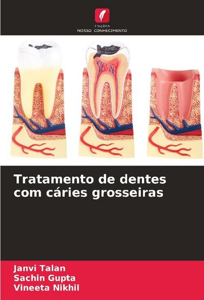 Tratamento de dentes com cáries grosseiras