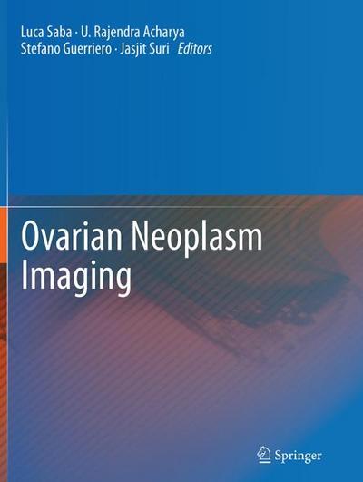 Ovarian Neoplasm Imaging