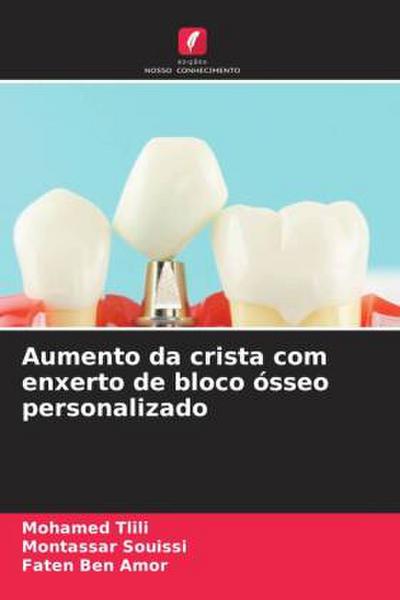 Aumento da crista com enxerto de bloco ósseo personalizado