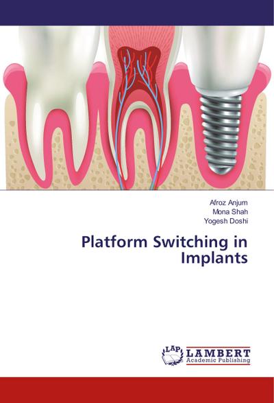 Platform Switching in Implants